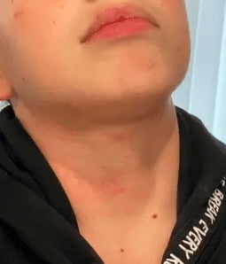 Middle School Boy Strangled by Female Classmate on School Bus… School Refuses to Expel Attacker [VIDEO]