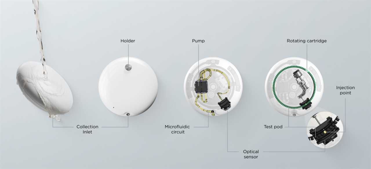 withings u-scan