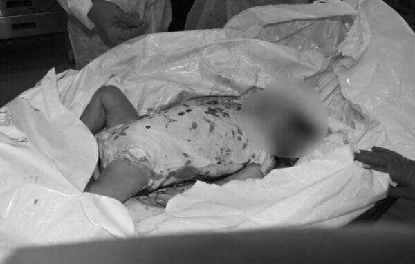 Office of Prime Minister Netanyahu Releases Horrifying and Disturbing Photos of Babies Murdered and Burned by Hamas Terrorists That Was Shown to Anthony Blinken