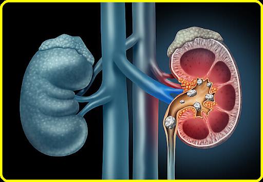 Get all your renal problems solved by the best nephrologists in Delhi