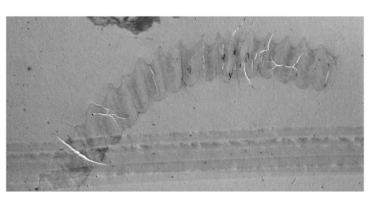 A black-and-white image of euglenoid cyst magnified showing its unusual structure