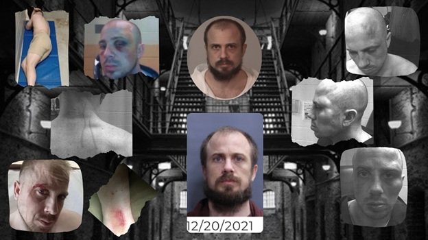 Collage of mugshots and injury photos highlighting a person's condition, dated December 20, 2021, set against a prison background.