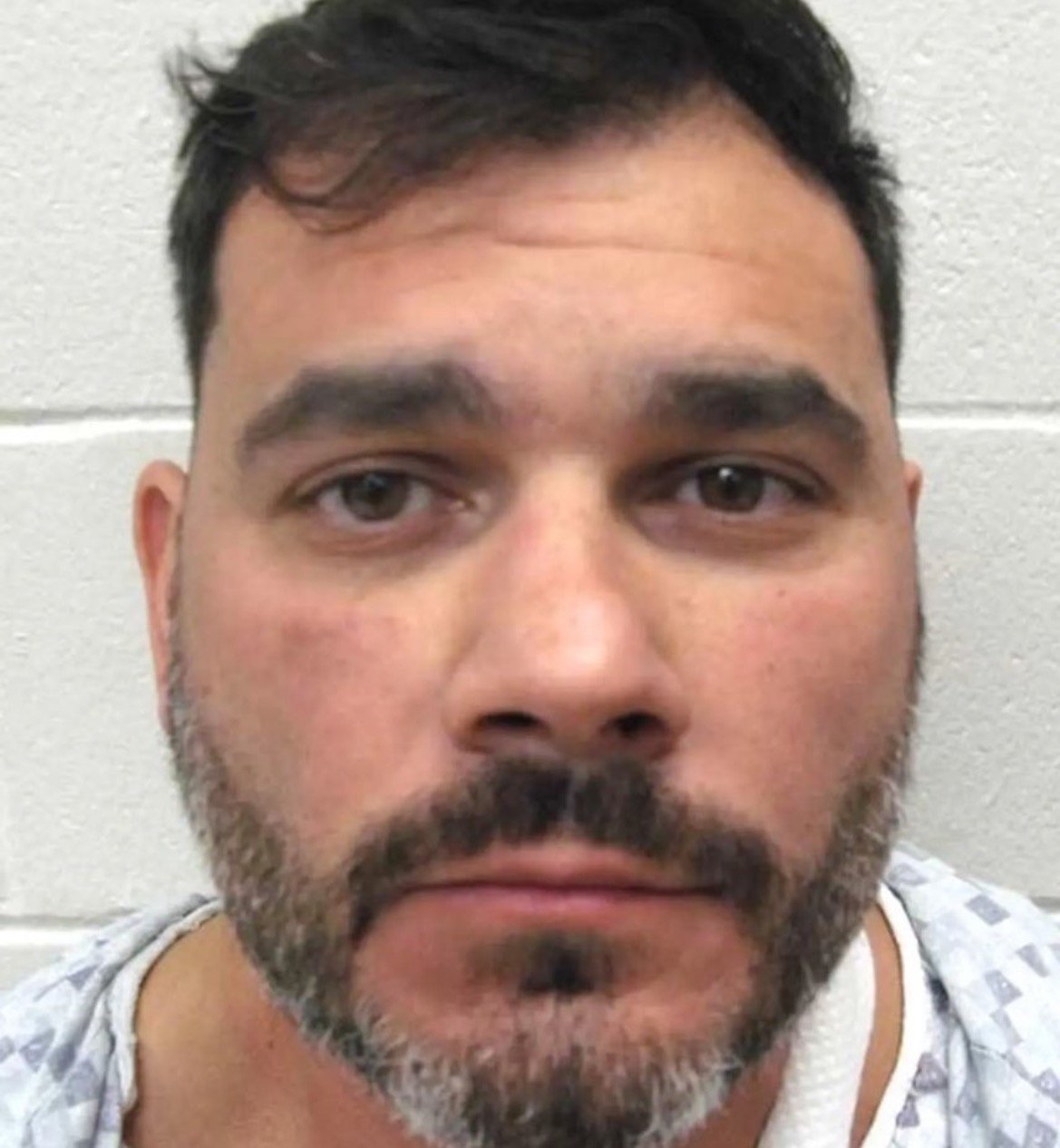 Close-up of a man with a beard wearing a hospital gown, showing a serious expression against a plain wall background.