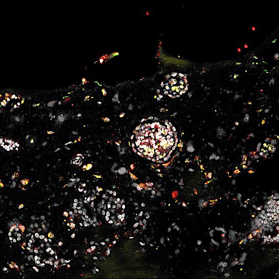 two embryos growing in placental tissue