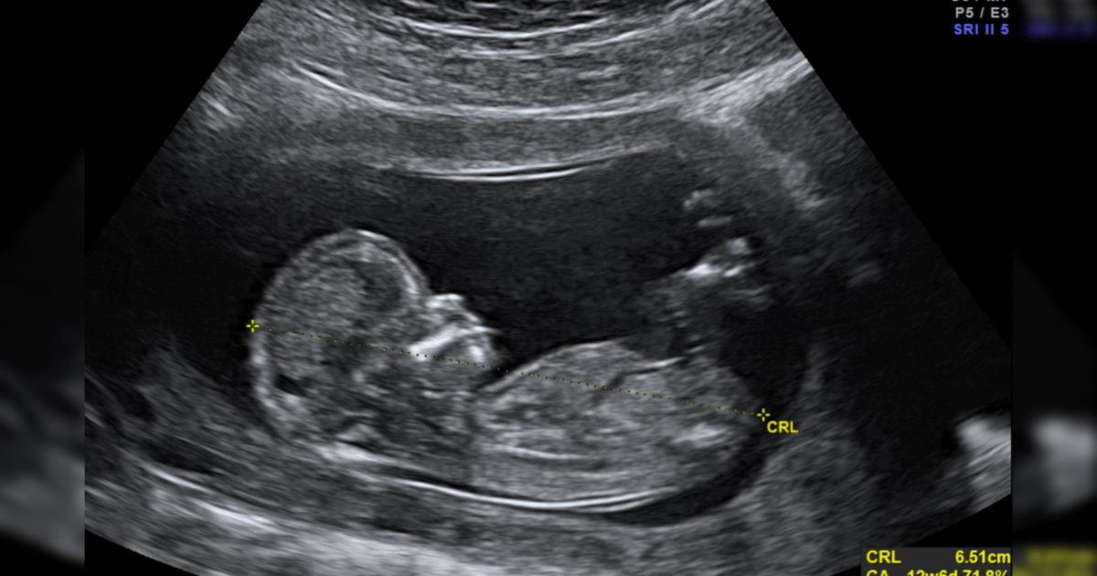 Abortion Providers Don’t Deserve Our Appreciation