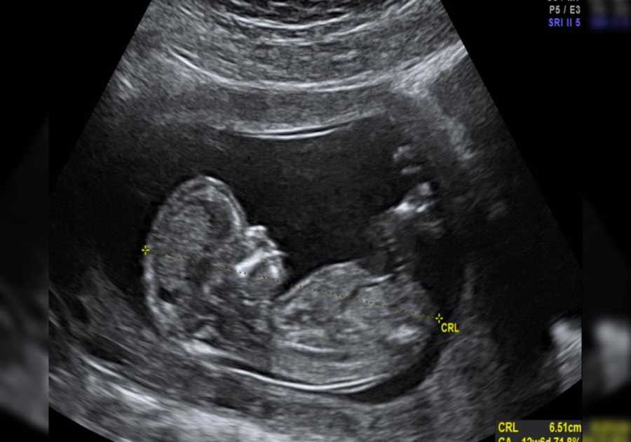 Abortion Providers Don’t Deserve Our Appreciation