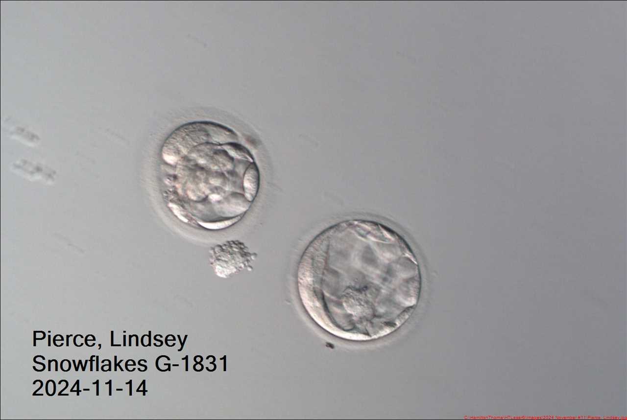 Exclusive: A record-breaking baby has been born from an embryo that’s over 30 years old