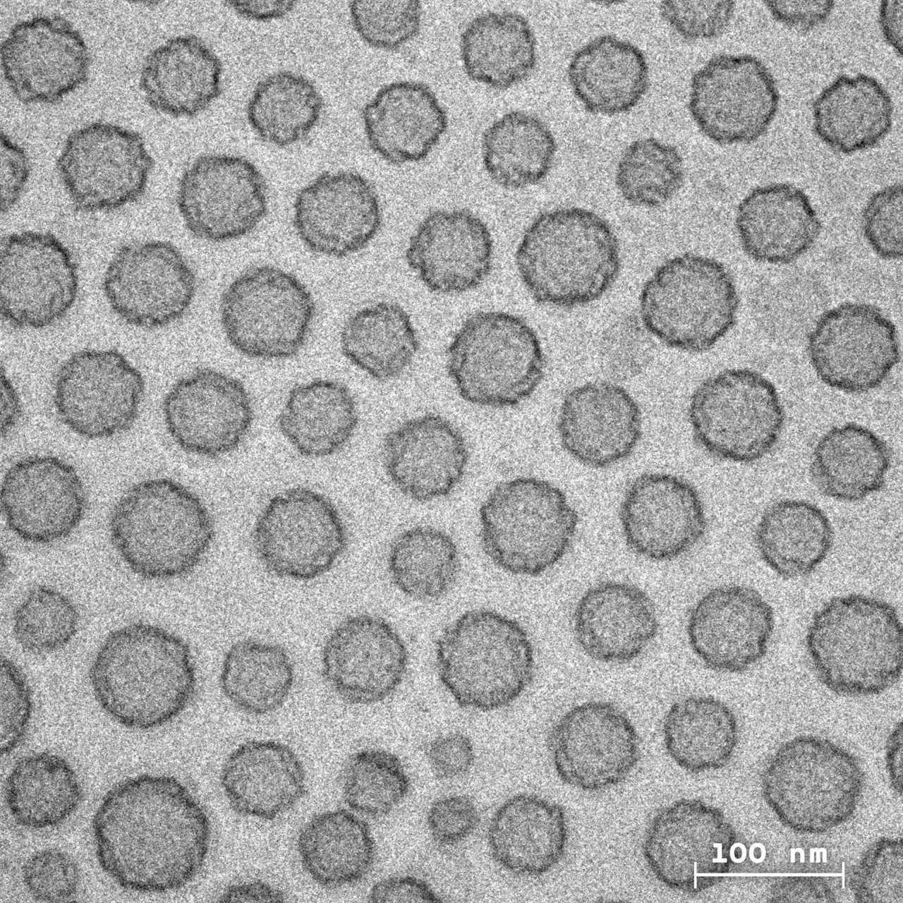 TEM image of platelets