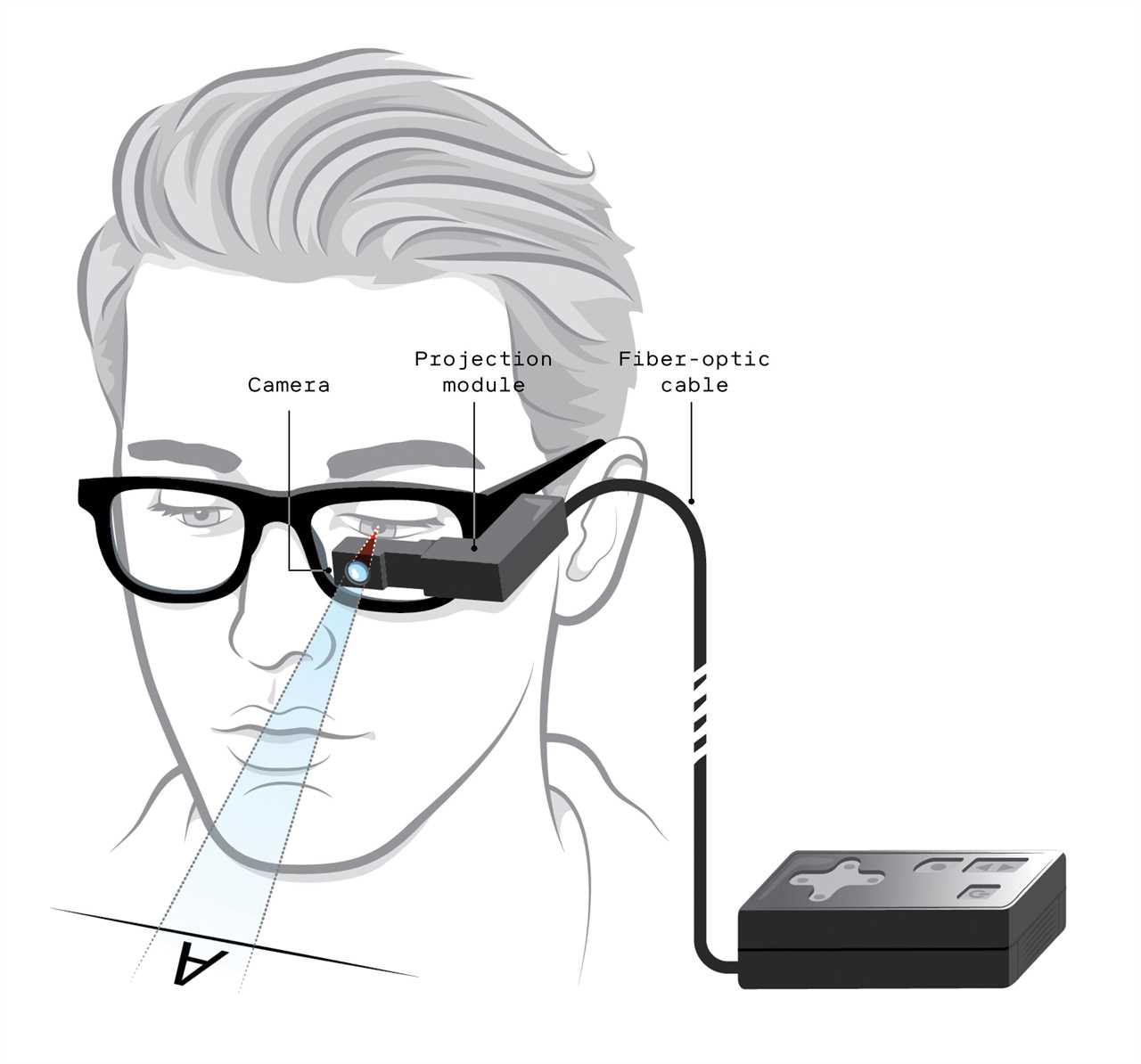 This implant can restore sight for patients with macular degeneration